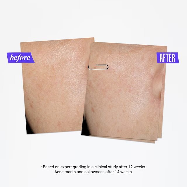 Kiehls Clearly Corrective Dark Spot Solution